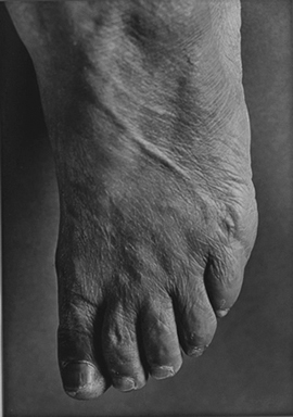 【石内都〈「25 MAR 1916」#5〉】